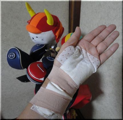 ゴルフ、できそうにもない！(；...