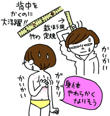 蕁麻疹