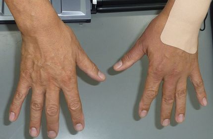 名誉の負傷その後