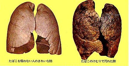 禁煙も出来ない「濡れ落ち葉」は...