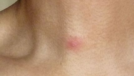Kissmarkではありません...