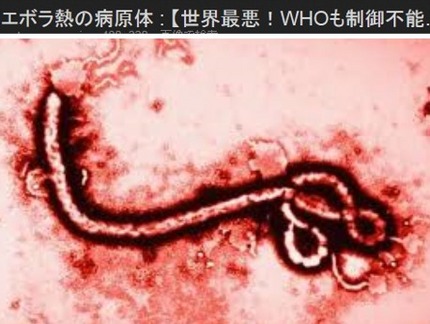 エボラ熱