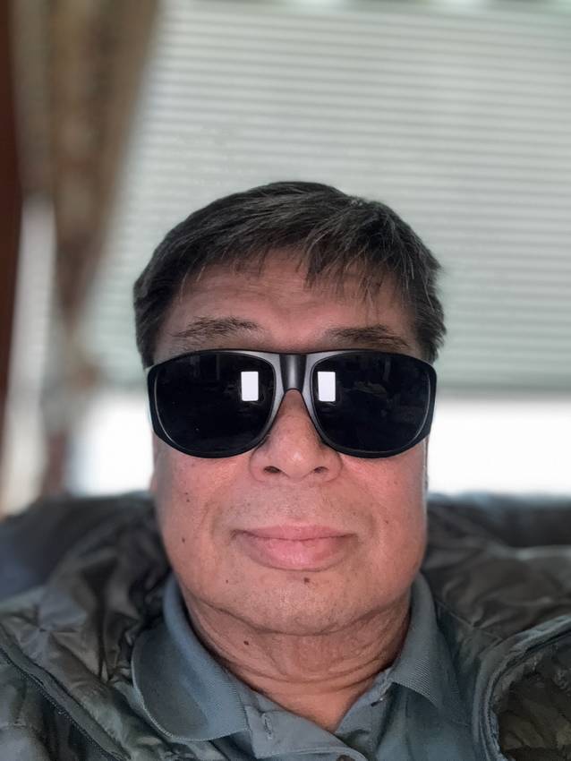 Cataract Surgery on my Right ...