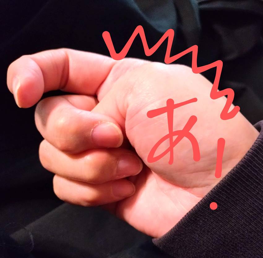 親指の関節がつる！ 今も画像見...